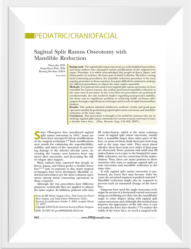 Thesis on Square jaw and Madibular surgery together