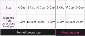 Size A Cup B Cup C Cup D Cup E Cup F Cup G Cup Distance from collarbone to nipple 10cm 12.5cm 15cm 17.5cm 20cm 22.5cm 25cm Normal breast size Macromastia